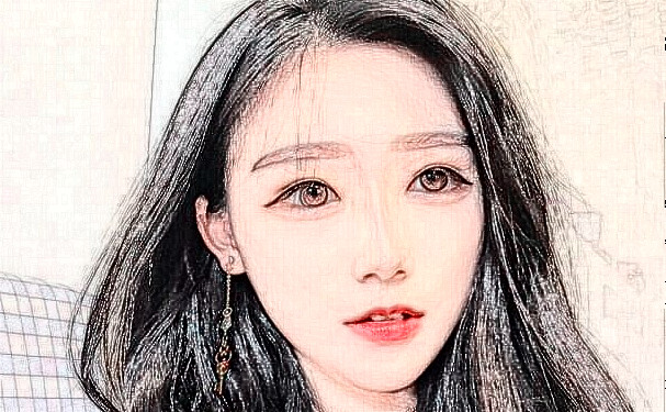 運(yùn)城市中心醫(yī)院岳長路太陽凹陷整形手術(shù)術(shù)后案例&價(jià)格明細(xì)?