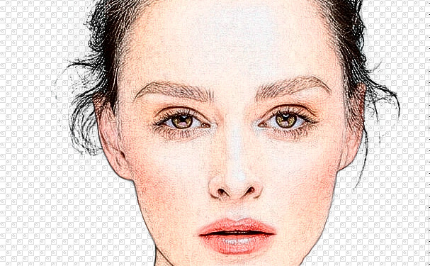 運(yùn)城市中心醫(yī)院岳長路太陽凹陷整形手術(shù)術(shù)后案例&價(jià)格明細(xì)?