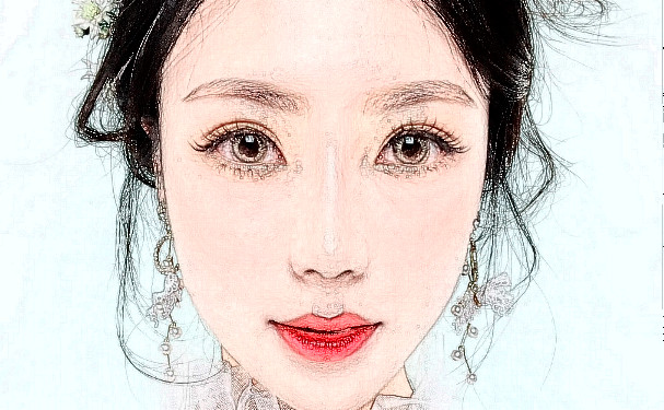 上海市同濟醫(yī)院鞏倫禮肥胖下頜角整形技術(shù)評價怎么樣?案例盤點&效果詳情