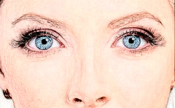 南通市中醫(yī)院叢綱新月雙眼皮術后120天案例|技術水準怎么樣?醫(yī)院實力分析