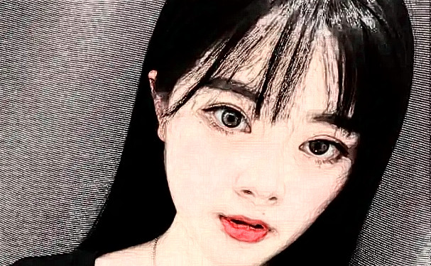 西京醫(yī)院馬顯杰玻尿酸豐唇術(shù)后6個(gè)月案例|技術(shù)特色怎么樣?醫(yī)生介紹