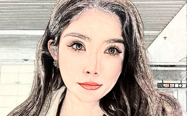 河南省人民醫(yī)院李雪莉豐淚溝心動案例&費用查詢?